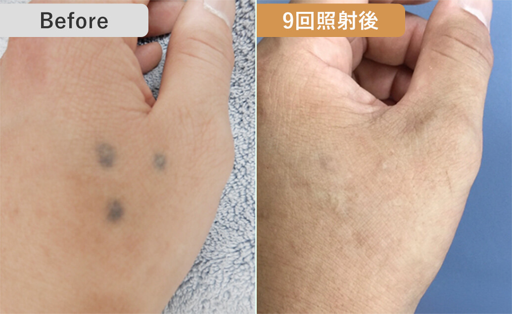 BEFORE/AFTER