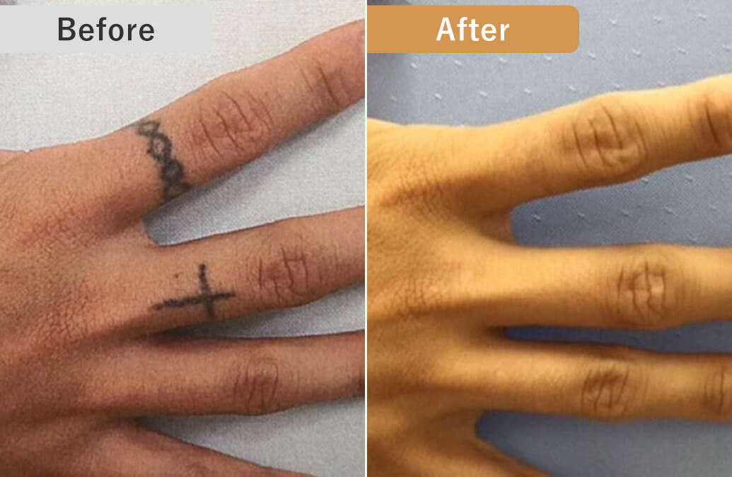 BEFORE/AFTER